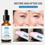Original Pretty Cowry™ Hyaluronic Acid Serum – 100% Natural Anti-Wrinkle Professional Skin Care